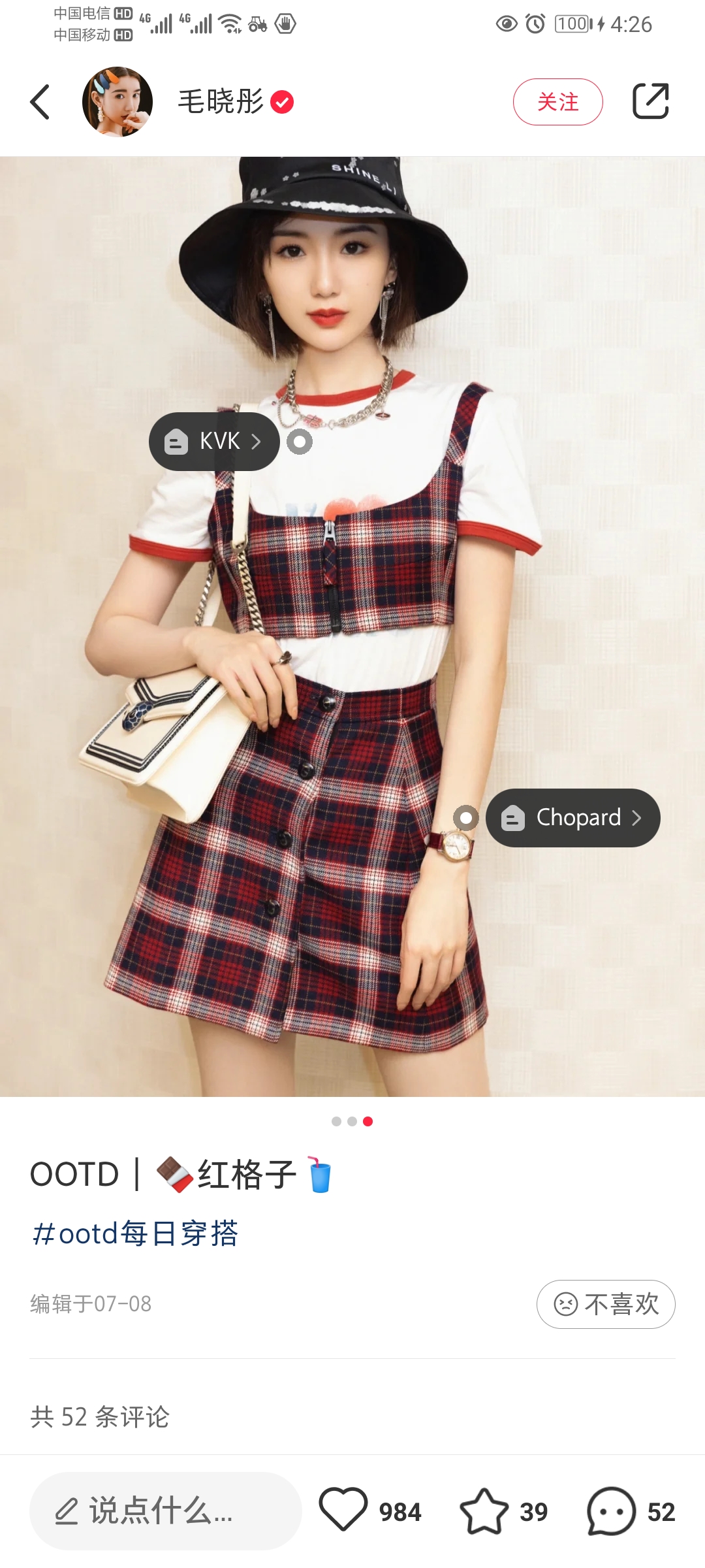 服装品牌明星艺人PR植入合作同款借衣明星上身露出(图4)